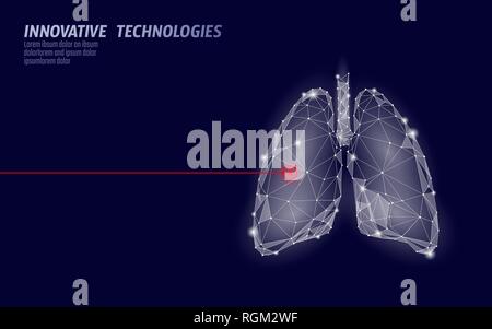 Menschliche lungen Laser Chirurgie operation Low Poly. Medizin Krankheit medikamentöse Behandlung schmerzhaft. Rote Dreiecke polygonale 3D-Render Form. Apotheke Stock Vektor