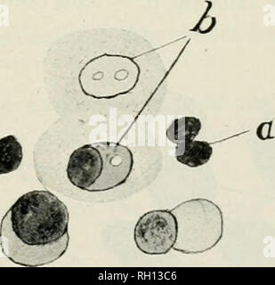 . Bulletin. Landwirtschaft - - Ontario. Abb. 20.^ aus der nasale Sekretion von Henne11 und 2Ti. Ciliated cell mit schleimigen Degeneration.. Abb. 21. - mit den Stellen, die von einem Tumor von Huhn Nr. 17. Sie versinken immer tiefer in die Gelatine. Die Oberfläche ist glatt und glänzend. Sie sind hell in der Farbe grau. Durch das Mikroskop, jungen Kolonien sind leicht körnige gesehen werden. Das Zentrum ist dunkler, gelblich bis braun, der Grenzzone klarer, und in der Regel mit dunkler, strahlen Markierungen; m ältere Kolonien, diese verschwinden, und die Gelatine wird an der Unterseite der Platte verflüssigt. Das Wachstum am Rande der c Stockfoto