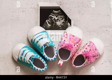 Blau und pink Booties neben Baby Fotos mit Ultraschall in der 20. Woche der Schwangerschaft. Warten auf das Baby. Schwangerschaft. Sohn oder Tochter. Selektive f Stockfoto