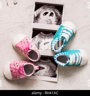 Blau und pink Booties neben Baby Fotos mit Ultraschall in der 4. Woche der Schwangerschaft. Warten auf Zwillinge. Sohn und Tochter. Selektiver Fokus Stockfoto