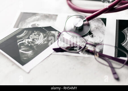 Phonendoscope vs Stethoskop und Gläser liegen auf Ultraschallbildern des Embryos bei 4 und 20 Wochen der Schwangerschaft. IVF in-vitro-Fertilisation Konzept. Ob Stockfoto