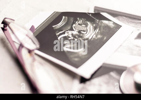 Phonendoscope vs Stethoskop und Gläser liegen auf Ultraschallbildern des Embryos bei 4 und 20 Wochen der Schwangerschaft. IVF in-vitro-Fertilisation Konzept. Ob Stockfoto