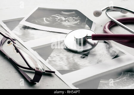 Phonendoscope vs Stethoskop und Gläser liegen auf Ultraschallbildern des Embryos bei 4 und 20 Wochen der Schwangerschaft. IVF in-vitro-Fertilisation Konzept. Ob Stockfoto