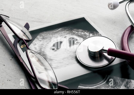 Eine phonendoscope oder Stethoskop und Gläser liegen auf Ultraschall Bilder eines Embryos von zweieiige Zwillinge in der 4. Schwangerschaftswoche. IVF in-vitro-Fertilisation. Stockfoto