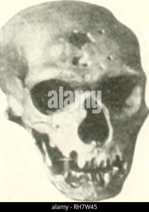 . Das Gehirn vom Affen zum Menschen; ein Beitrag zur Untersuchung der Entwicklung und der Entwicklung des menschlichen Gehirns. Gehirn; Evolution; Pongidae. . Bitte beachten Sie, dass diese Bilder sind von der gescannten Seite Bilder, die digital für die Lesbarkeit verbessert haben mögen - Färbung und Aussehen dieser Abbildungen können nicht perfekt dem Original ähneln. extrahiert. Tilney, Friedrich, 1875-1938; Riley, Henry Alsop, 1887 -. New York, S. B. Hoeber, Inc. Stockfoto