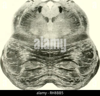 . Das Gehirn vom Affen zum Menschen; ein Beitrag zur Untersuchung der Entwicklung und der Entwicklung des menschlichen Gehirns. Gehirn; Evolution; Pongidae. . Bitte beachten Sie, dass diese Bilder sind von der gescannten Seite Bilder, die digital für die Lesbarkeit verbessert haben mögen - Färbung und Aussehen dieser Abbildungen können nicht perfekt dem Original ähneln. extrahiert. Tilney, Friedrich, 1875-1938; Riley, Henry Alsop, 1887 -. New York, S. B. Hoeber, Inc. Stockfoto