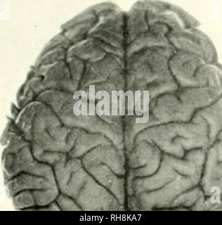 . Das Gehirn vom Affen zum Menschen; ein Beitrag zur Untersuchung der Entwicklung und der Entwicklung des menschlichen Gehirns. Gehirn; Evolution; Pongidae. . Bitte beachten Sie, dass diese Bilder sind von der gescannten Seite Bilder, die digital für die Lesbarkeit verbessert haben mögen - Färbung und Aussehen dieser Abbildungen können nicht perfekt dem Original ähneln. extrahiert. Tilney, Friedrich, 1875-1938; Riley, Henry Alsop, 1887 -. New York, S. B. Hoeber, Inc. Stockfoto