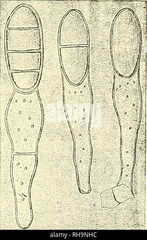 . Botanische Zeitung. Pflanzen, Pflanzen. 93 regelmäßiger Spaltöffnung vor. Sterben Grehäuse sind schwarzbraun und überaus brüchig. Sterben heller gefärbten Pykniden besitzen einen schwarzbraunen Saum um den Perus, wie er häufig an den Fruchtgehäusen, so erscheint bei Septoria- und Phyllosticta-Formen. Der Porusrand ist rauh, wie kurz gefranzt. Eine Querschnitten zeigt sich, wie, sterben im Durchschnitt ellipsenförmige Pyknide mit Sonthofen halsförmiger Verlängerung das opidermale Rindengewebe durchbricht und mit erweiterter Halsmündung (Abb. 4) frei die Oberfläche tritt, 5/6 der bauchförmige Teil der Pyknid Stockfoto
