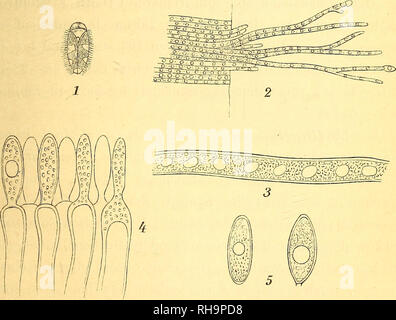 . Botanisk Tidsskrift". Botanik; Pflanzen; pflanzen. 127 iøjnefaldende røde Pletter, der fulgte de større Ribber af Bladene bredte sig herfra og til Siderne, den medens svarende til - Unterseite var bedaekket af det graaviolette Laad, dannet af de taetsiddende Konidier Frugthyfer og. Pythium Baryanum Hessen foraarsagede en hidtil ukjendt Asparges - Sygdom; ich Tranekjaer haben bleve nemlig talrige Asparges - skud angrebne af denne Parasit (se iøvrigt Gartner-Tidende für 1894, S. 101, med Afbildning). 3. JEJntomophthoraceae. Ich August 1894 fandt cand. mag. O. in Rostrup i Tidsvilde en stor Maengde Skum Exemplarer af Stockfoto