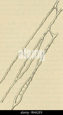 . Botanische Zeitung. Pflanzen, Pflanzen. 651 652 This Hohlräume erscheinen anfänglich als feine Spalten, 12 Bay sich dann all-mählich, so dass sie die ursprüngliche Gestalt der Knoten annehmen. Als strecken sie sich etwas mehr in die Länge, so dass ihre Natur als Intercellularräume ganz unzwei Felhaft - ist. Derartige bereits vergrösserte Hohlräume liegen manchmal vereinzelt zwi-schen kleineren, nur mit undeutlichen Inter-cellularräumen versehenen Verdickungen, mitunter ist aber auch ein großer Theil der Zellwand mit Reihe relativ grosser Intercellularräume umsäumt. Schliesslich g Stockfoto