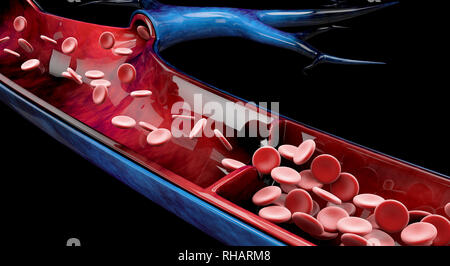 Krampfadern hautnah. Menschlichen Beinen auf einem schwarzen Hintergrund, 3D-Darstellung. Stockfoto