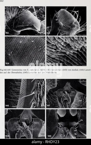 . Bonner zoologische nach 1550. Zoologie. Abb. 146-149: D. fasciata, REM: (146) Zähnchenkamm des Gonostylus; (147) Genitalkapsel, von frontalen; (148) Angaben von (147), Dorsalsklerit mit dichter Behaarung; (149) Penes, von frontalen.. Bitte beachten Sie, dass diese Bilder sind von der gescannten Seite Bilder, die digital für die Lesbarkeit verbessert haben mögen - Färbung und Aussehen dieser Abbildungen können nicht perfekt dem Original ähneln. extrahiert. Bonn, Zoologisches Forschungsinstitut und Museum Alexander Koenig Stockfoto