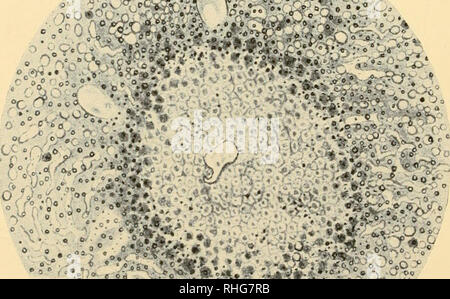 . Biologische Vorlesungen an der Marine Biologische Laboratorium des Holz Holl [sic] geliefert. Biologie. Experimentelle Abszess in der Niere des Kaninchens. Staphylococcus pyogenes aureus Infektion. Abb. Ii. Experimentelle focal Zelle Nekrose in der Leber der Meerschweinchen. Ricin Rausch.. Bitte beachten Sie, dass diese Bilder sind von der gescannten Seite Bilder, die digital für die Lesbarkeit verbessert haben mögen - Färbung und Aussehen dieser Abbildungen können nicht perfekt dem Original ähneln. extrahiert. Marine Biologische Laboratorium (Woods Hole, Massachusetts). Boston, Ginn &Amp; Co Stockfoto