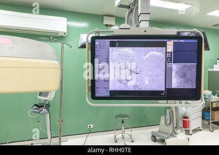 Digitale Subtraktionsangiographie, DSA-lab, Monitor große C-Arm angiograph, Operationssaal mit X-ray Medizintechnik im Krankenhaus. Stockfoto