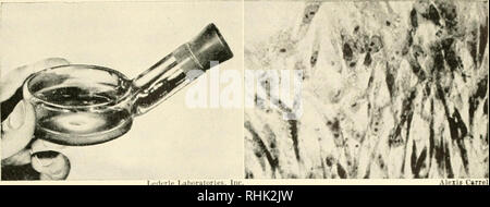 . Biologie und Mann. Biologie; Menschen. Li'iiirle Laljuiatorics. Jin-. Die KULTUR DES UNSTERBLICHEN HUHN GEWEBE IM LABOR 1912 Dr. Alexis Carrel der Rockefeller Institut entfernt kleine Stücke des Herzmuskels aus einem hühnerembryo noch in der eihülle, ungefähr in der neunten oder zehnten schlüpfen. Er legte diese Fragmente in einem Nährboden, auf eine angemessene Temperatur und mit Luft. Alle zwei Tage die wachsende Stück verdoppelt in der Größe; es wurde geteilt und ein Teil in einem frischen Mittel gelegt. Dies hat sich in all den Jahren. Die meisten der neuen Wachstum hat, von Cou Stockfoto