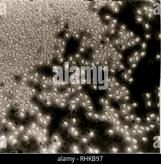 . Biologie und Kolonisierung der Sand fly Lutzomyia diabolica (Halle) (Diptera: Psychodidae) mit Hinweisen auf seine mögliche Beziehung zu menschlichen kutane Leishmaniose in Texas, USA. Psychodidae, Leishmaniose, kutane; Insekten als Überträger von Krankheiten, Insekten. Abbildung 2-25. Microsporidian Sporen in der hemocoel eines weiblichen Lutzomyia diabolica gesammelt an Garner State Park, Uvalde County, Texas, USA, Juni 1982 (ca. magn. x2100). Bitte beachten Sie, dass diese Bilder aus gescannten Seite Bilder, die digital für die Lesbarkeit verbessert haben mögen - Färbung und Aussehen dieser illust extrahiert werden Stockfoto