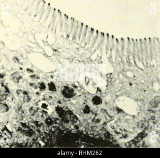 . Biologische Struktur und Funktion; Verfahren. Biochemie; Zytologie. PINOCYTOSIS 159 Schumaker [27]. Brandt induzierte pinocytosis in Amöben durch ein fluoreszierendes Protein, und könnte direkt zeigen, dass ein fluoreszierendes Film auf die Oberfläche der Amöbe adsorbiert ist und dass der gleiche Film beschichtet die Innenseite der Pinocytosis Kanäle und Pinocytosis Vakuolen. Seitdem sind weitere Beispiele für die Adsorption von Pinocytosis-Induktoren gefunden [21, 15]. In Bezug auf die Art der adsorbierende Websites die Hypothese wurde von Marshall, Schumaker, und Brandt [15] erweitert wurde und b Stockfoto