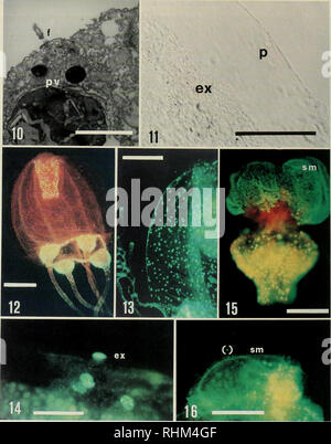 . Die biologische Bulletin. Biologie; Zoologie; Meeresbiologie. Abbildung 10. Elektronenmikroskopische Aufnahme eines isolierten Fragment der aktivierten quergestreiften Muskelgewebe Umwandlung in Glatten - Muskel - wie, Flagellated Zellen, pv = periphere Vesikel, f=flagellum. Skala: 5 ^m. Abbildung 11. Destabilisiert exumbrellar Epidermis (ex) von Umwandlung Turrilopsis nulricula Medusa, zeigen große perisarc Sekretion (p). Skala: 80 iim. Abbildung 12. Podocoryne camea Medusa. BrdU-Färbung der DNA-Replikation Kerne (mit freundlicher Genehmigung von G. PLICKERT). Replizieren von Kerne sind in des Brustbeins und tentacular Glühlampen konzentriert. Stockfoto