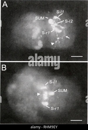 . Die biologische Bulletin. Biologie; Zoologie; Biologie; Meeresbiologie. NEURODEVELOPMENT IN APLYSIA OKNICA CALIh' 311. Abbildung 5. Serolonin-LIR Zellen und Fasern in Aplyxia ciilifornicii während der Tage 8-9. Anterior nach rechts in jedem Bild. (A) der rechten seitlichen Blick auf ein Embryo am Tag 9, Serotonin-LIR Zellen in der Apikalen Orgel (S-/1,-/2, S-RL. SUMl und Fasern projizieren in den Fuß (Pfeilspitze) und velum (Pfeil). Scale Bar = 30/xm. (B) Die dorsalen Ansicht eines Embryo am Tag S zeigt drei der Serotonin-LIR Zellen (S-/I. S-RL. Summe) der apikalen Orgel. Die apikale Commissure wird angegeben durch Stockfoto
