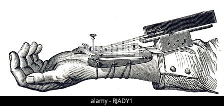 Ein kupferstich mit der Darstellung eines sphygmograph, ein Gerät erfunden von Étienne-Jules Marey für die Aufnahme der Puls und Variationen grafisch in Blut und Druck. Étienne-Jules Marey (1830-1904), ein französischer Wissenschaftler, Physiologe und chronophotographer. Vom 19. Jahrhundert Stockfoto