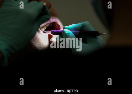 Details mit den Händen einer Frau, Zahnarzt, mit OP-Handschuhe, arbeiten mit speziellen Werkzeugen im Mund eines Patienten Stockfoto