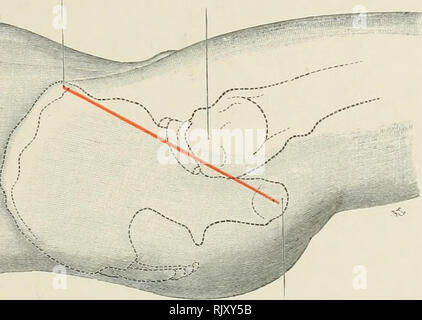 . Atlas der Angewandten (Topografische) menschlichen Anatomie für Studenten und Praktiker. Anatomie. o H OS. Bitte beachten Sie, dass diese Bilder sind von der gescannten Seite Bilder, die digital für die Lesbarkeit verbessert haben mögen - Färbung und Aussehen dieser Abbildungen können nicht perfekt dem Original ähneln. extrahiert. Bardeleben, Karl Heinrich, 1849-1919; Haeckel, Ernst Heinrich Philipp August, 1834-1919. London: Rebman Limited, New York, Rebman Unternehmen Stockfoto