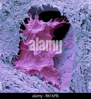 Osteocyte Knochen Zelle, SEM Stockfoto