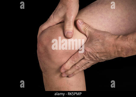 Arthrose im Kniegelenk. Stockfoto