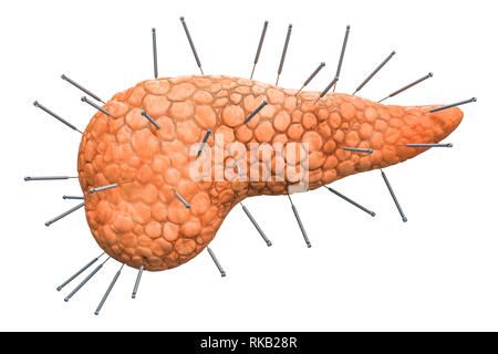 Die menschliche Bauchspeicheldrüse mit Akupunktur Nadeln. Akupunktur Behandlung von Bauchspeicheldrüsenkrebs Konzept, 3D-Rendering auf weißem Hintergrund Stockfoto