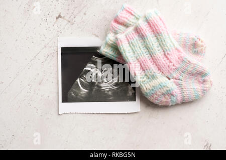 Gestrickte rosa Socken für das Kind DIY, liegen auf dem Bild Ultraschall. Warten auf das Kind, Schwangerschaft. Selektiver Fokus Stockfoto