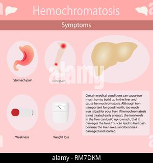 Symptome von hemochromatosis der Leber. Vector Illustration Infografiken Stock Vektor