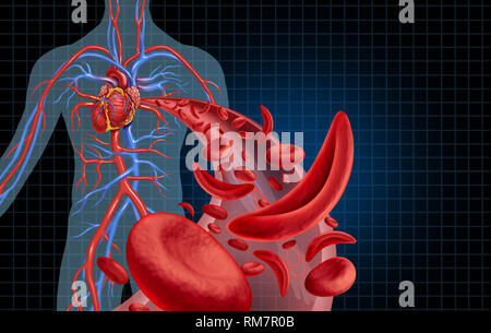 Sichelzelle Herz-kreislauf Herz Kreislauf und Anämie als Krankheit mit normalen und abnormalen Hämoglobin in einem menschlichen Arterie Anatomie. Stockfoto