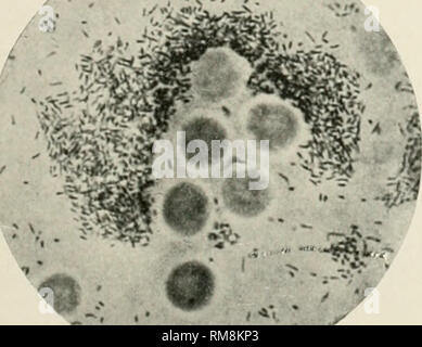 . Jahresbericht der Direktor des Büros der Wissenschaft... Philippinen. Büro der Wissenschaft; Wissenschaft - Philippinen. &Gt; -.-V^^ Abb. 2. Amöbe mit Vibrio cholera und lep-rosa Bacillus G. Zweiten trans-Anlage von primären Kultur. ?-^, i | H-. JWte.-. '%: •''^^"* ¥ "*?= Mt* Abb. 4. Kultur G. Lepra Bazillen mit Bild. 3. Abstrich vom frühen Läsion in Meerschweinchen folgenden Amöben und Cholera Vibrionen. Eine subkutane Injektion mit einem reinen Kultur der gebeizt mit oarbol - fuchsin und Lepra bacillus F. entfärbt mit Gabbet's Fleck. Platte IV. Bitte beachten Sie, dass diese Bilder aus gescannten Seite extrahiert werden Stockfoto