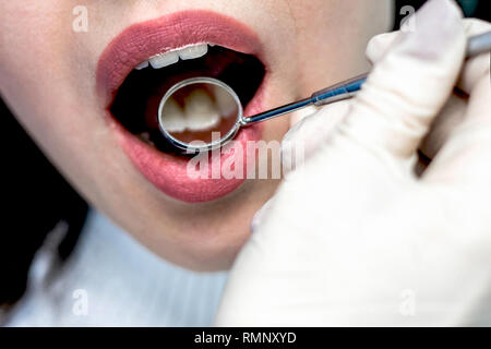 Patienten offenen Mund in der mündlichen Überprüfung durch Zahnarzt. Stockfoto