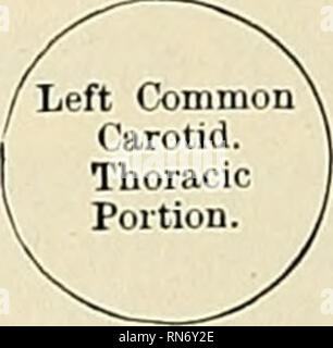 . Anatomie, beschreibende und angewendet werden. Anatomie. 584 VA&amp; CVLAB SYSTEME Kanals und der Linken wiederkehrende Laryngeal Nerv. Auf der rechten Seite, es ist im Zusammenhang mit der innomi - nate Arterie, inf Schilddrüse Venen, und bleibt der Thymusdrüse. Auf der linken Seite, mit der linken N. vagus, linke Pleura, und linken Lungenflügel. Die linke A. subclavia ist hinten und leicht Extern. Plan der Beziehungen der linken A. carotis. Thorax- Teil. Vor. 1 Brustbein. Und sternohyoid Sternothyroid Muskeln. Links innominate Vene. Bleibt der Thymusdrüse. Intemallv. / Extern. ^ I 1. Stockfoto