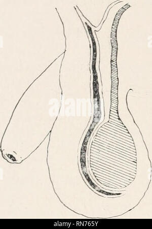 . Anatomie auf den Punkt: Eine Abhandlung über die Anatomie des Menschen in seiner Beziehung zu Osteopathie. Die menschliche Anatomie; osteopathische Medizin osteopathische Medizin; Anatomie. ENCYSrtO HERNIE. Bitte beachten Sie, dass diese Bilder sind von der gescannten Seite Bilder, die digital für die Lesbarkeit verbessert haben mögen - Färbung und Aussehen dieser Abbildungen können nicht perfekt dem Original ähneln. extrahiert. Laughlin, William Ross. Kirksville, Missouri: William Ross Laughlin Stockfoto