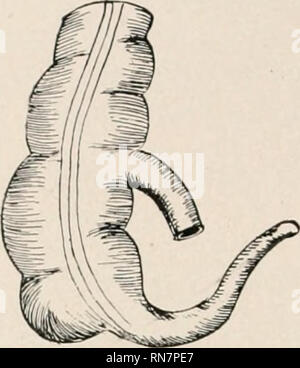 . Anatomie auf den Punkt: Eine Abhandlung über die Anatomie des Menschen in seiner Beziehung zu Osteopathie. Die menschliche Anatomie; osteopathische Medizin osteopathische Medizin; Anatomie. Platte CLVIH.. Nr. 2.. Bitte beachten Sie, dass diese Bilder sind von der gescannten Seite Bilder, die digital für die Lesbarkeit verbessert haben mögen - Färbung und Aussehen dieser Abbildungen können nicht perfekt dem Original ähneln. extrahiert. Laughlin, William Ross. Kirksville, Missouri: William Ross Laughlin Stockfoto