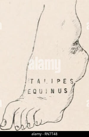 . Anatomie auf den Punkt: Eine Abhandlung über die Anatomie des Menschen in seiner Beziehung zu Osteopathie. Die menschliche Anatomie; osteopathische Medizin osteopathische Medizin; Anatomie. Platte LXXXIX.. Bitte beachten Sie, dass diese Bilder sind von der gescannten Seite Bilder, die digital für die Lesbarkeit verbessert haben mögen - Färbung und Aussehen dieser Abbildungen können nicht perfekt dem Original ähneln. extrahiert. Laughlin, William Ross. Kirksville, Missouri: William Ross Laughlin Stockfoto