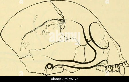 . Anatomischer Anzeiger. Anatomie, Vergleichende; Anatomie, Vergleichende. 293 Innen. Der Abstand von der Sut. Abs. des SUT. squam. beträgt etwa 13 m. M. und von der ersten bis zur Sut. sagittahs ca. 30 m. M. unter der Herkunftsort des SUT. Par. out des SUT. Adr. Wir sehen die frontal in die parietale Knochen mit einem großen runden Bogen, die anormal ist, für die in der Regel eine hervorstehende Teil der parie - Geschichte dringt in das Stirnbein durchdringend. Mit diesem müssen wir vergleichen, z. B. Eanke's (1) Bilder der Orang-utan-outang auf S. 34, 36, 40, 41, beide auf S. 42 und S. 43. Die Linea te Stockfoto