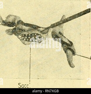 . Anatomischer Anzeiger. Anatomie, Vergleichende; Anatomie, Vergleichende. Ampanh Amp. Ant.. Amp. post V Anp. hor. • Amppoa Abb. 1. Abb. 2. Abb. 1. Modell des rechten Utriculus mit Ampullen, von unten gesehen. Abb. 2. Modell des rechten Utriculus und Sacculus, von medial gesehen. Sacculus wendet seine Maculaflache dem zu betrachtenden. Auch this ist durch Punktierung hervorgehoben, und zwar das vordere Ende durch schwarze Punkte in hellem Grunde, der größere hintere Teil durch W^eiße Punkte auf dunklem Grund. This verschiedene Punktierung bezieht sich auf die doppelte Innervation der Macula sacculi; Stockfoto