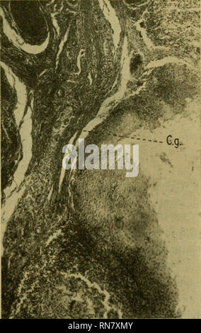 . Anatomischer Anzeiger. Anatomie, Vergleichende; Anatomie, Vergleichende. 283 VoiNOT, Essai sur repithelium de la Trompe de Fallope Chez la Femme. Diese Nancy 1900. Zit. nach Schaffer 1908. Wilson, J.T., Beobachtungen, die nach jungen menschlichen Embryonen. Journ. Von Anat. und Kurt von Figura. Bd. 48, 1914. Junge, J., Eeproduction im menschlichen weiblichen; die Uterusschleimhaut in der Stillstehenden, Menstruation und Schwangerschaft, und die Funktion der Dezidua, mit einem Konto eines frühen menschlichen Eizelle. Edinburgh und London 1911. Nachdruck verboten. Sulla presenza di Cellule gangliari uella TonslUa palatina Umana. Pro Gaspare Stockfoto