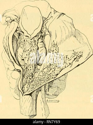 . Anatomischer Anzeiger. Anatomie, Vergleichende; Anatomie, Vergleichende. 206 minderwertig oder zwischen Constrictor minderwertig und medius hindurchtreten und Teile des Plexus pharyngeus bilden. Außerdem ziehen aus den mittleren Abschnitten Venen des Doi alwärts unmittelbar zwischen den Muskelbündeln hindurch, ebenfalls in der Höhle Plexus pharyngeus eingeliend und damit schließlich in die Vena thyreoidea Superior führend. This letzteren Abflüsse stehen regelmäßig mit Venen an der Dorsalfläche der Glandula thyreoidea, Ästen der Vena thyreoidea Superior, in Verbin-dung, außerdem zeigt fast immer sterben eine oder und Stockfoto