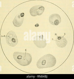 . Anatomischer Anzeiger. Anatomie, Vergleichende; Anatomie, Vergleichende. 291 blasteukernen Gleichen, in der Größe und Färbung aber erheblich variieren. Eine ihrer Kernnatur kann kein Zweifel sein. Uebergänge zu den echten "blutplättchen" des Präparates waren massenhaft vor-handen. Ob sie wirklich einfache physiologische Umwandlungen des Normoblastenkernes vorstellen, entzieht sich meiner Kenntnis. Als "abgeblaßte Kerne "im Sinne Israel-Pappenheims sind sie allein schon aus dem Grunde nicht zu bezeichnen, daß ihre Gewinnung mit. Abb. 1. Vollständige Erythrocyten mit" Plättchenkernen", Stockfoto