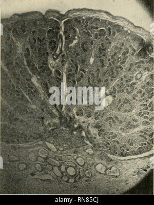 . Anatomischer Anzeiger. Anatomie, Vergleichende; Anatomie, Vergleichende. 255 AusmünduDg und bei der großen Enge der Harnröhre verblieb der Harn in der Blase. Abb. führen in der so anormal entwickelten Harnröhre Klappen, ähnlich denen der Venen, ein. Einen ähnlichen Fall berichtet Portal (1) von einem Embryo, nicht wegen fast gänzlichen Fehlens der Harnröhre der Harn sich durch den Urachus in eine außerhalb des Bauches befindliche Blase ergoß, sterben eine Größe schnell dem Körper des Embryos gleichkam. Auch Oberteufer (17) beobachtete den Austritt des Harns aus dem Nabel bei einem weiblichen Em bryo, dem Sterben Ureth Stockfoto