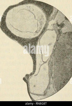 . Anatomischer Anzeiger. Anatomie, Vergleichende; Anatomie, Vergleichende. 59 Abb. 20. Der ModeU Hörblase des Forellenembryos (4 mm Länge). wächst dann durch lebhafte mitotische Teilung Thunfischwadenfänger Epithelzellen stark in die Länge. Wie verhalten sich Nonne sterben Knochenfische in Bezug auf den Ductus endolymphaticus? Wenn sich das Hörbläschen unsere ab-geschnürt hat, stellt es, wie Abb. 20 zeigt, ein kleines, ovales Bläschen dar, in dessen Wand- kahl Zapfen eindringen, welche die Entstehung der halbcirkelförmigen Kanäle einleiten. Von einems Ductus endolymphaticus ist hier nicht das geringste zu beme Stockfoto