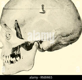 . Anatomische Hefte. Abb. 13. 14, 15, 16, 17, 18, 19, 20, 21. Bitte beachten Sie, dass diese Bilder sind von der gescannten Seite Bilder, die digital für die Lesbarkeit verbessert haben mögen - Färbung und Aussehen dieser Abbildungen können nicht perfekt dem Original ähneln. extrahiert. München [etc. ] J. F. Bergmann Stockfoto