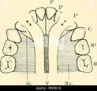 . Anatomische Hefte. Der Zwischenkiefer, Entsteh, u. Verlauf d. Hasenschartenkieferspalte etc. 599 e, an der sich der mittlere Nasenfortsatz mit dem Ober-kieferfortsatze vereinigt, hat. Wenn Nonne durch irgend welche Gründe this Vereinigung ausgeblieben ist, so ist die Folge oft darauf, dass Sterben durch die Zahnleiste entstandene Spalt-bildung unterbrochen wird. Abgesehen von der Anlage fin-den zweiten Schneidezahn, Werdener sterben übrigen Zahnanlagen in normaler Weise aus der zahnleiste sich entwickeln. Wie Rnuss sich aber dabei sterben Anlage für den zweiten Schneidezahn verhalten? Ich glaube, Stockfoto