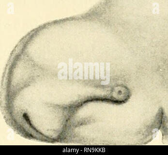 . Anatomische Hefte. Der Zwischenkiefer, Entsteh, u. Verlauf d. Hasenschartenkieferspalte usw. 513 trachtet ist der seitliche Nasenfortsatz vorn breit und hinten schmal bis zum Auge ausgezogen. Die ganze Ausdehnung des seitlichen Nasenfortsatzes ist besonders deutlich im Bild. 7. Abb. 6. An. Nl. . Bitte beachten Sie, dass diese Bilder sind von der gescannten Seite Bilder, die digital für die Lesbarkeit verbessert haben mögen - Färbung und Aussehen dieser Abbildungen können nicht perfekt dem Original ähneln. extrahiert. München [etc. ] J. F. Bergmann Stockfoto