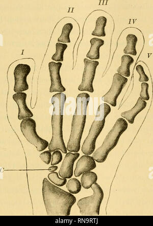 . Anatomische Hefte. Die Entwicklung der Knochen. 37 This Beobachtung ist deshalb von so großer Wichtigkeit, weil das Gegcnbaur Limatum der Mammalia in Homologie gesetzt hat mit dem Intermedinm der Amphibien, jenem Knochen des Karpus, der Hineinragt" zwischen sterben Nummern-oper mit Stand Figur ß.. Dorsalansiclit der rechten Hand eines Ca. lOwöchentl. menschlichen Embryonen. Methylenblau-Cederuholzöl - Balsam. Der stark geschwungene Proc. Styl. uln. e mit der Dorsalfläche des Triquetrum in Berührung. Im Carpus, dessen Elemente bereits näher an-einander gerückt sind, persistiert noch ein Centrale (C) Stockfoto