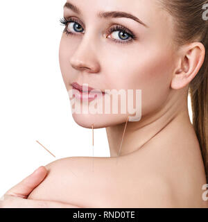 Junge Frau, die sich einer Akupunkturbehandlung. Stockfoto